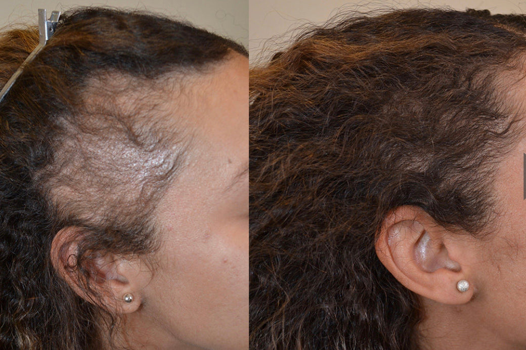 “Stimulate Me” Hair and Scalp treatment