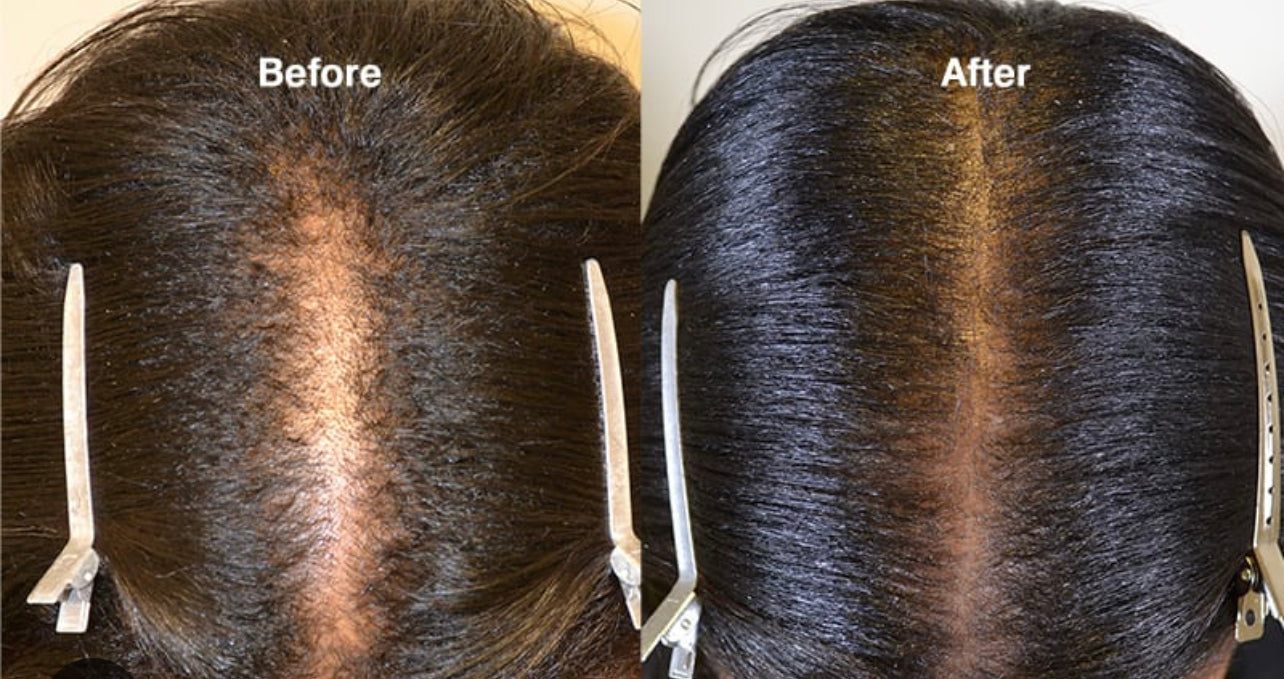 “Stimulate Me” Hair and Scalp treatment